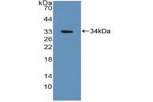 Detection of Recombinant PTPN2, Human using Polyclonal Antibody to Protein Tyrosine Phosphatase, Non Receptor Type 2 (PTPN2) (PTPN2 抗体  (AA 1-257))