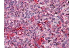 Immunohistochemical analysis of paraffin-embedded human Spleen tissues using FGR mouse mAb
