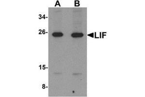 Western blot analysis of LIF in 3T3 cell lysate with LIF antibody at (A) 1 and (B) 2 μg/ml. (LIF 抗体  (Center))
