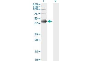 Western Blotting (WB) image for anti-Fc Fragment of IgE, Low Affinity II, Receptor For (CD23) (FCER2) (AA 1-321) antibody (ABIN560857)