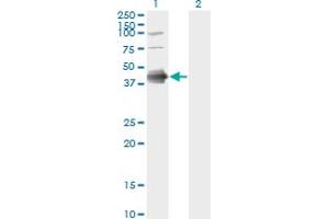 Western Blot analysis of FCER2 expression in transfected 293T cell line by FCER2 monoclonal antibody (M03), clone S52. (FCER2 抗体  (AA 1-321))