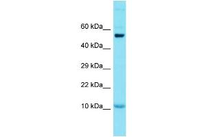 Host: Rabbit Target Name: GCSAML Sample Type: Placenta lysates Antibody Dilution: 1. (GCSAML 抗体  (N-Term))
