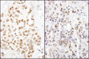 Immunohistochemistry (IHC) image for anti-High Mobility Group Nucleosome Binding Domain 1 (HMGN1) (AA 90-100) antibody (ABIN7455239)