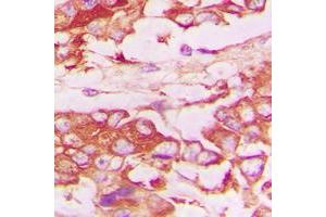 Immunohistochemistry (IHC) image for anti-Tumor Necrosis Factor Receptor Superfamily, Member 1B (TNFRSF1B) (C-Term) antibody (ABIN7297172)