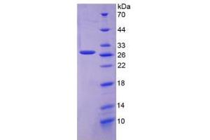 SDS-PAGE analysis of Human FOLR1 Protein. (FOLR1 蛋白)