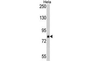 Western blot analysis of AP17766PU-N SRP72 antibody in Hela cell line lysates (35 µg/lane). (SRP72 抗体  (Middle Region))