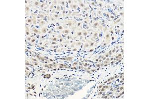 Immunohistochemistry of paraffin-embedded rat ovary using Pan-Akt Rabbit pAb (ABIN7265520) at dilution of 1:100 (40x lens). (AKT 1/2/3 抗体)
