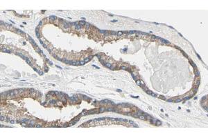 ABIN6269185 at 1/100 staining Human prostate tissue by IHC-P. (TNNI3 抗体)