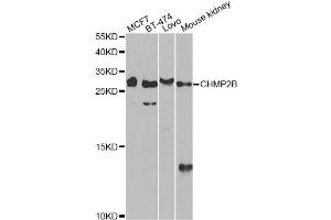 Western blot analysis of extracts of various cell lines, using CHMP2B antibody. (CHMP2B 抗体)