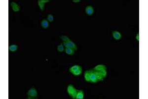 Immunofluorescent analysis of HepG2 cells using ABIN7149764 at dilution of 1:100 and Alexa Fluor 488-congugated AffiniPure Goat Anti-Rabbit IgG(H+L) (Desmin 抗体  (AA 2-86))