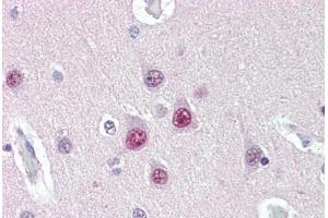 Human Brain, Cortex (formalin-fixed, paraffin-embedded) stained with UBQLN1 antibody ABIN396937 at 10 ug/ml followed by biotinylated anti-mouse IgG secondary antibody ABIN481714, alkaline phosphatase-streptavidin and chromogen. (Ubiquilin 1 抗体  (Internal Region))