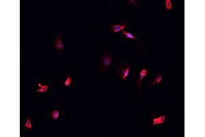 ABIN6269030 staining A-431 cells by IF/ICC. (p63 抗体)