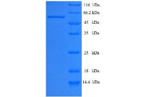 CAPN2 Protein (AA 1-324) (His tag)