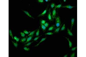 Immunofluorescence staining of Hela cells with ABIN7151786 at 1:133, counter-stained with DAPI. (EDC4 抗体  (AA 753-952))
