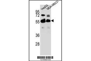 Western blot analysis in HepG2,MDA-MB231 cell line lysates (35ug/lane). (RAP1GDS1 抗体  (AA 217-244))