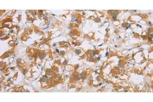 Immunohistochemistry (Paraffin-embedded Sections) (IHC (p)) image for anti-Cytochrome P450, Family 2, Subfamily E, Polypeptide 1 (CYP2E1) antibody (ABIN7236721)