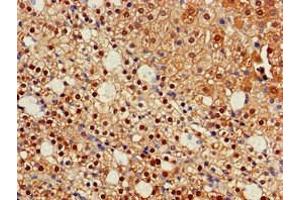 Immunohistochemistry of paraffin-embedded human adrenal gland tissue using ABIN7157120 at dilution of 1:100 (IDH1 抗体  (AA 1-240))