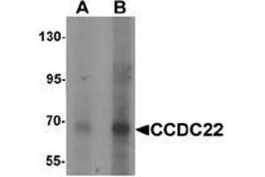 Western blot analysis of CCDC22 in 293 cell lysate with CCDC22 antibody Cat,. (CCDC22 抗体  (N-Term))
