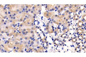Detection of CD26 in Mouse Kidney Tissue using Polyclonal Antibody to Cluster Of Differentiation 26 (CD26) (DPP4 抗体  (AA 29-178))
