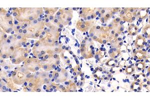 Detection of CD26 in Mouse Kidney Tissue using Polyclonal Antibody to Cluster Of Differentiation 26 (CD26)