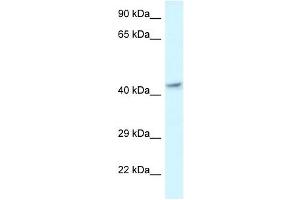 Western Blot showing MECR antibody used at a concentration of 1 ug/ml against Fetal Brain Lysate (MECR 抗体  (C-Term))