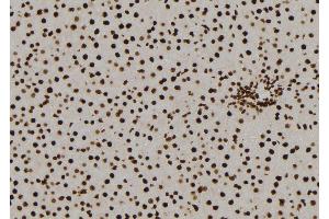 ABIN6277585 at 1/100 staining Rat liver tissue by IHC-P. (NQO2 抗体  (N-Term))