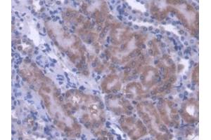 Immunohistochemistry (IHC) image for anti-Acyl-CoA Dehydrogenase, C-2 To C-3 Short Chain (Acads) (AA 210-397) antibody (ABIN5013074)