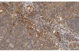 ABIN6266692 at 1/100 staining human Lymph node tissue sections by IHC-P. (RANKL 抗体  (Internal Region))