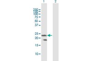 Western Blot analysis of F8 expression in transfected 293T cell line by F8 MaxPab polyclonal antibody.