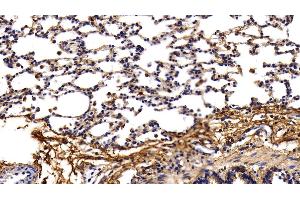 Detection of PINP in Rat Lung Tissue using Polyclonal Antibody to Procollagen I N-Terminal Propeptide (PINP) (PINP 抗体  (AA 23-151))
