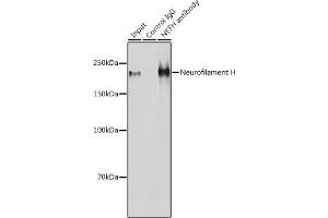 Immunoprecipitation analysis of 600 μg extracts of Mouse brain cells using 3 μg Neurofilament H antibody (ABIN6129638, ABIN6144512, ABIN6144513 and ABIN6224502). (NEFH 抗体  (AA 821-1020))