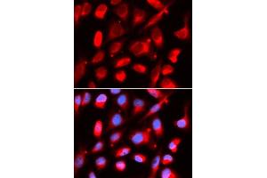 Immunofluorescence analysis of U2OS cells using UROD antibody. (UROD 抗体  (AA 1-367))