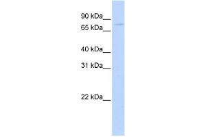 WB Suggested Anti-APP Antibody Titration:  0. (APP 抗体  (Middle Region))