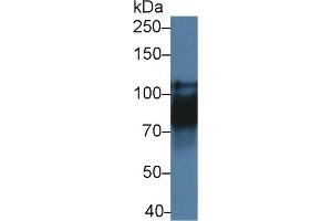 Detection of CDH16 in Rat Kidney lysate using Polyclonal Antibody to Cadherin 16 (CDH16) (Cadherin-16 抗体  (AA 353-617))