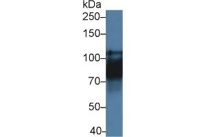 Detection of CDH16 in Rat Kidney lysate using Polyclonal Antibody to Cadherin 16 (CDH16) (Cadherin-16 抗体  (AA 353-617))