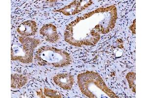 IHC analysis of GLIS1 using anti-GLIS1 antibody (ABIN7599501).
