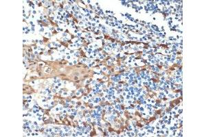 Immunohistochemistry of paraffin-embedded Human tonsil using HSPA1A Monoclonal Antibody at dilution of 1:100 (40x lens). (HSP70 1A 抗体)
