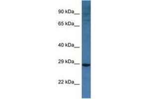 Image no. 1 for anti-BCL2/adenovirus E1B 19kDa Interacting Protein 3-Like (BNIP3L) (AA 92-141) antibody (ABIN6747290) (BNIP3L/NIX 抗体  (AA 92-141))