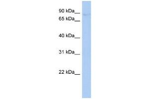 WB Suggested Anti-PLOD2 Antibody Titration:  0.
