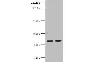 Western blot All lanes: Ubiquitin-conjugating enzyme E2 J2 antibody at 5 μg/mL Lane 1: HepG2 whole cell lysate Lane 2: Rat small intestine tissue Secondary Goat polyclonal to rabbit IgG at 1/10000 dilution Predicted band size: 29, 25, 31 kDa Observed band size: 29 kDa (UBE2J2 抗体  (AA 1-230))