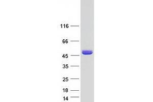 Western Blotting (WB) image for Aspartoacylase (ASPA) (Transcript Variant 2) protein (Myc-DYKDDDDK Tag) (ABIN2714659)