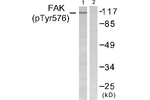 Western blot analysis of extracts from NIH/3T3 cells, using FAK (Phospho-Tyr576) Antibody (#A0426). (FAK 抗体  (pTyr576))