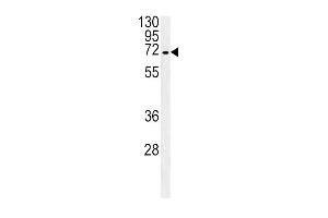 SLC22A1 Antibody (C-term) (ABIN657865 and ABIN2846821) western blot analysis in HepG2 cell line lysates (35 μg/lane). (SLC22A1 抗体  (C-Term))