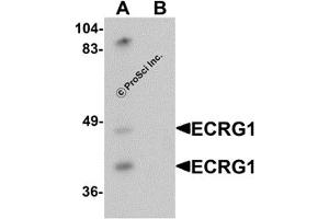 Western Blotting (WB) image for anti-Transmembrane Protease, Serine 11A (TMPRSS11A) (C-Term) antibody (ABIN1030374) (TMPRSS11A 抗体  (C-Term))