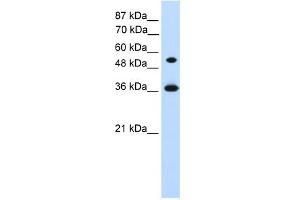 WB Suggested Anti-HOXC11 Antibody Titration:  1. (HOXC11 抗体  (Middle Region))