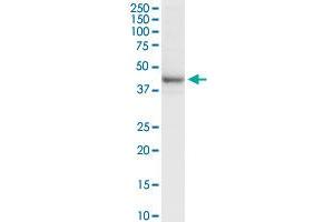 RRM2 MaxPab rabbit polyclonal antibody. (RRM2 抗体  (AA 1-389))