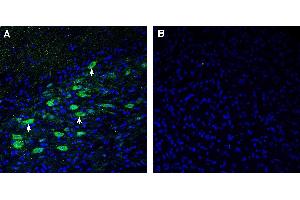 Expression of CADM1 in mouse deep cerebellar nuclei.