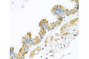 Immunohistochemistry of paraffin-embedded Human trachea using PCDHA12 Polyclonal Antibody at dilution of 1:100 (40x lens). (PCDHA12 抗体)