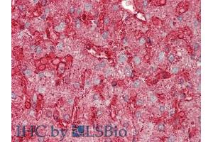 IHC-P analysis of Human Liver Tissue, with HE staining. (Annexin IV 抗体  (AA 11-164))