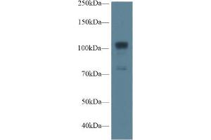 Western Blotting (WB) image for anti-Nitric Oxide Synthase 1, Neuronal (NOS1) (AA 468-616) antibody (ABIN1860025)